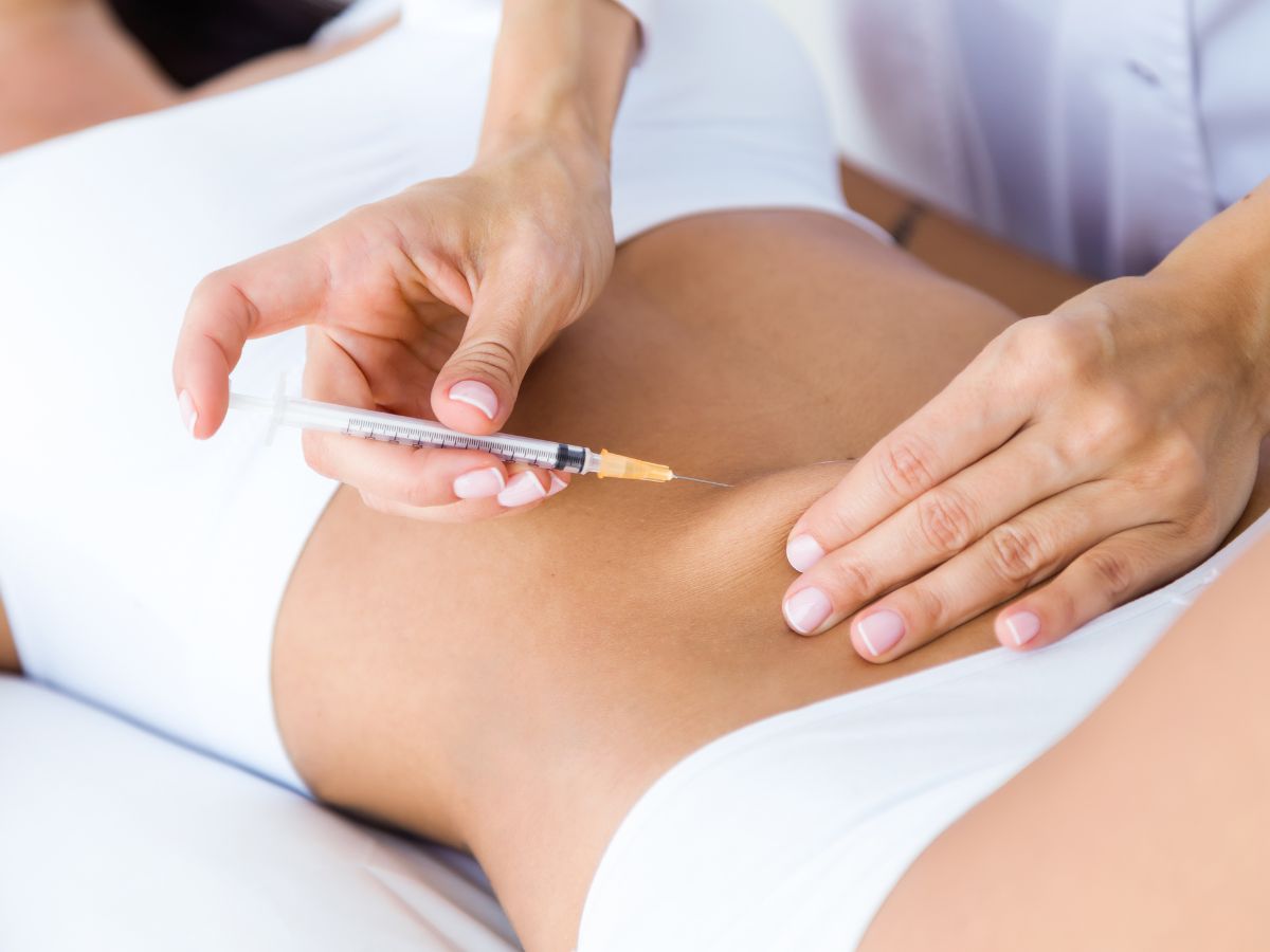 Mesotherapy Lipolysis