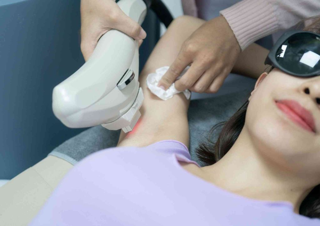 underarm laser hair removal