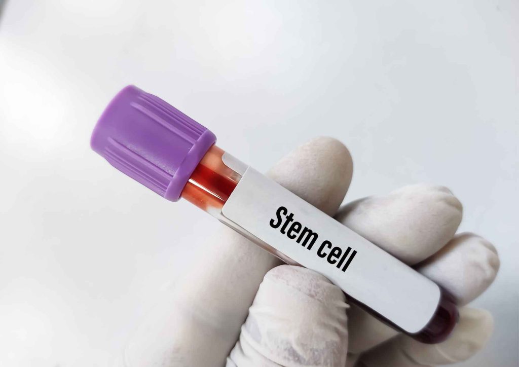 mesenchymal stem cells