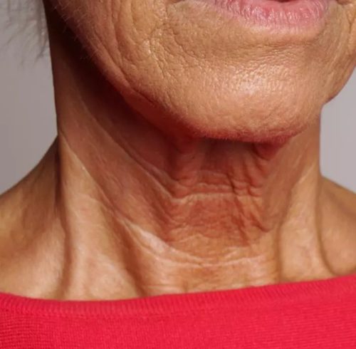 Neck Lines Neck Lines